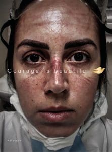 courage is beautiful ad